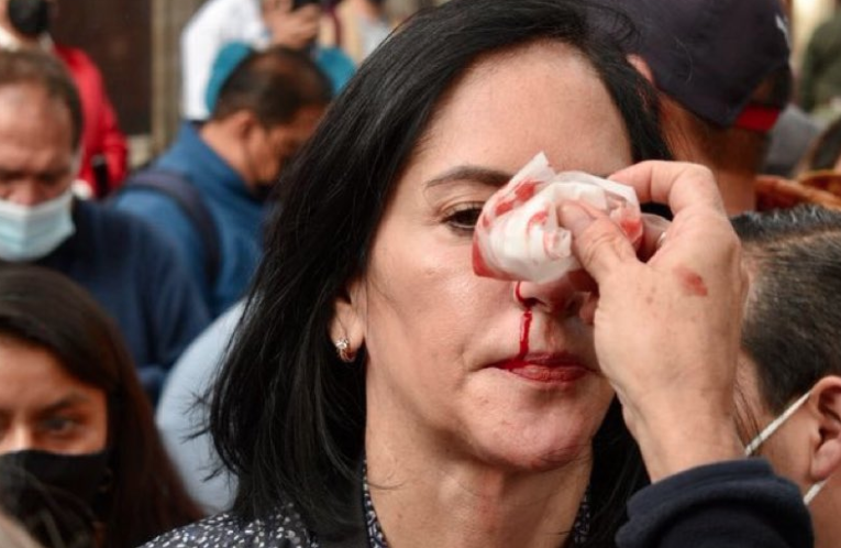 Alcaldes de oposición, quienes protestaban afuera del Congreso, fueron agredidos.