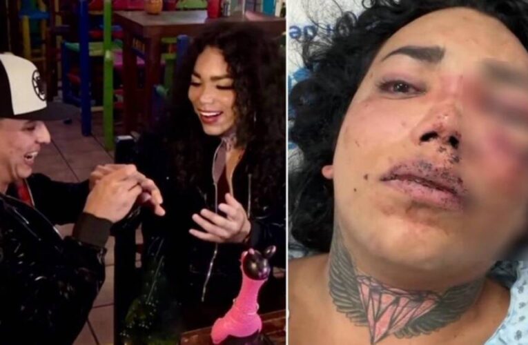 Paola Suárez fue atacada brutalmente por su novio; ya interpuso demanda en su contra