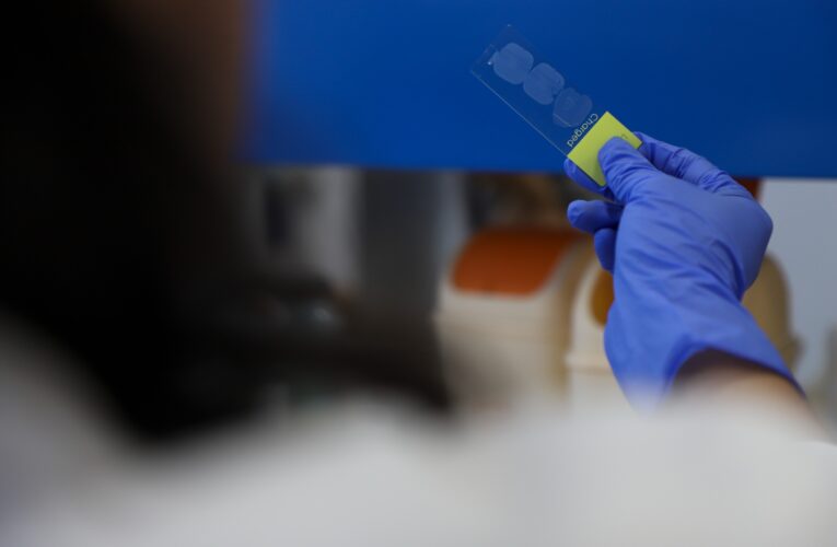 Estudiante de la UAQ investiga el potencial del garambullo en la prevención del cáncer de colon